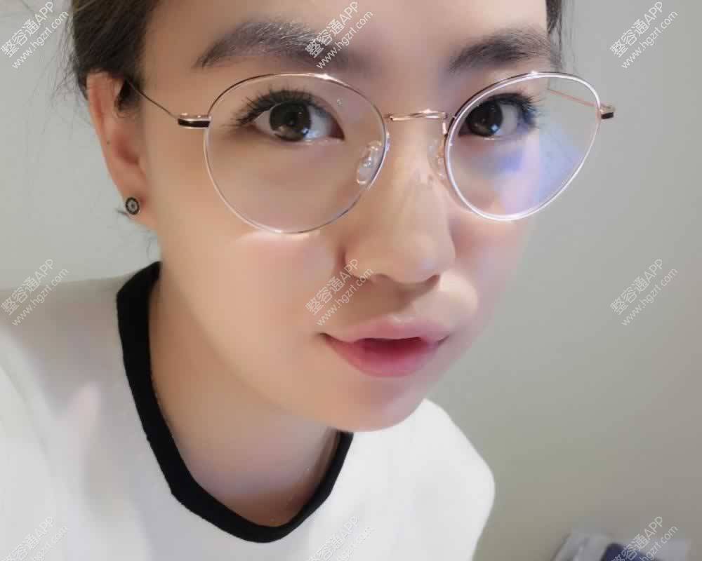 女性供卵试管婴儿中的取卵步骤有哪些？