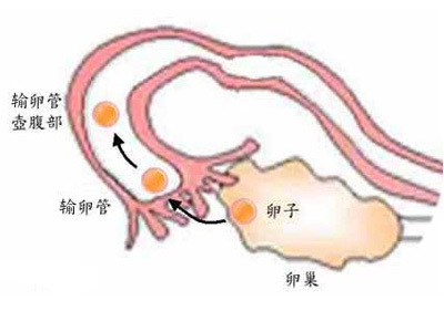 武汉婴泰医院的赠卵试管婴儿怎么样？在Sweeting上注册，