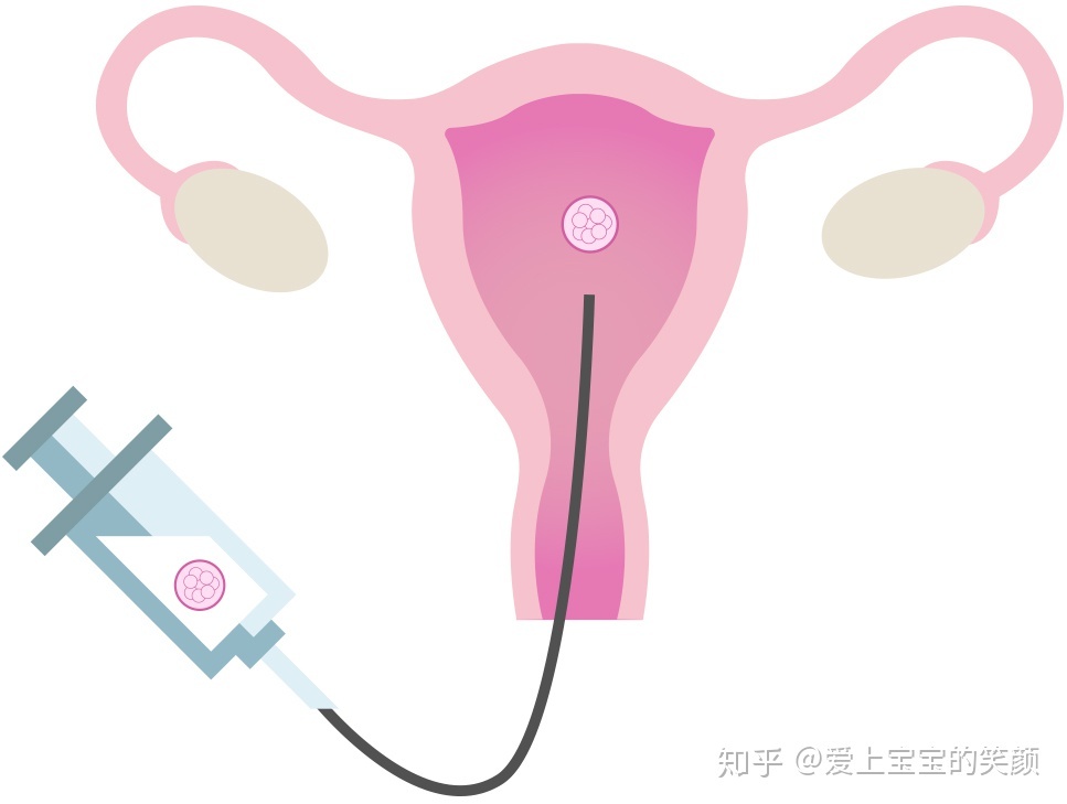 如果你做过赠卵试管婴儿，请告诉我们哪里的成功率高，看哪个试管婴儿医生比较好？谢谢!
