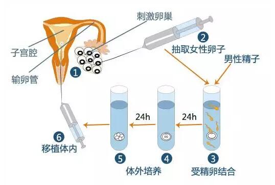 供卵试管婴儿宫颈口短是什么意思-供卵试管婴儿宫颈口短是什么意思