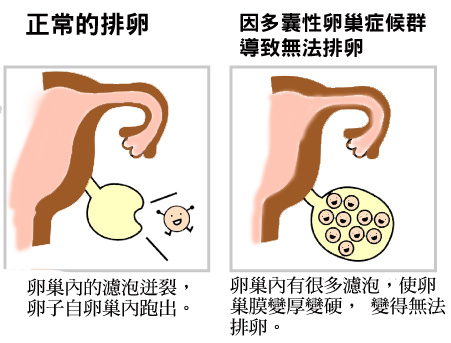 供卵试管婴儿有什么风险吗？