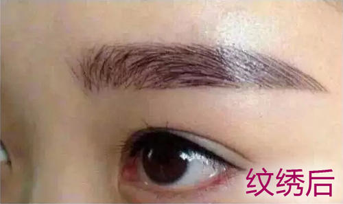 供卵试管婴儿中养成的囊胚质量4bc--供卵试管婴儿4bb是什么意思
