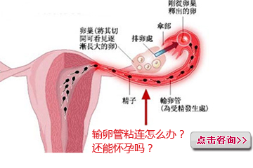影响湖北武汉供卵试管婴儿费用的因素有哪些？