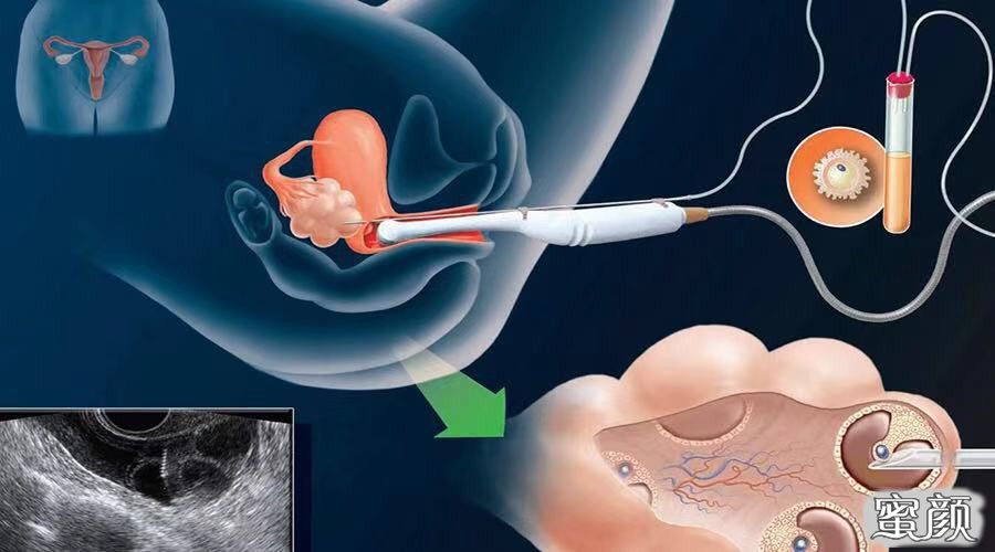供卵试管医院怀孕后可以上班吗，私立供卵试管怀孕后可以上班吗