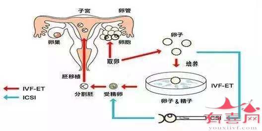 过来人经验分享!柬埔寨FCC生殖诊所实用指南