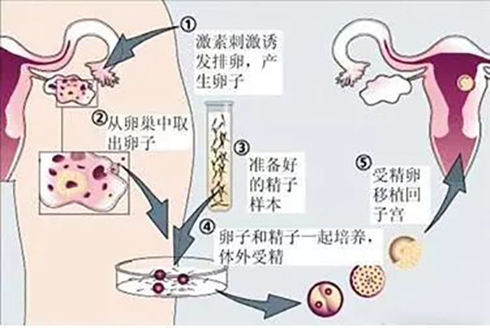 湖北大学附属医院生殖医院供卵做试管婴儿vip套餐