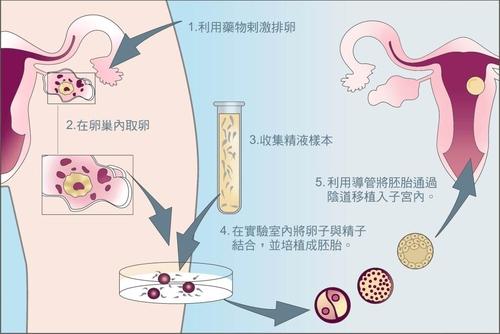 武汉市试管婴儿是骗局