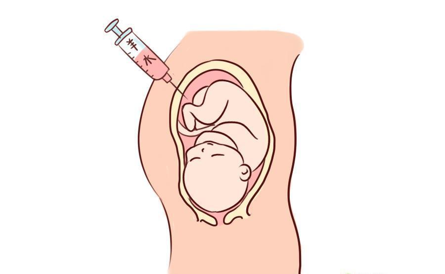49岁高龄女性二代什么是试管代怀一次成功生双胞胎的案例多吗？