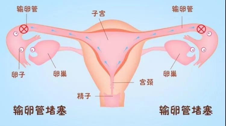 武汉地下国内试管代怀哪家最好靠谱吗(34岁7次试管没成功)