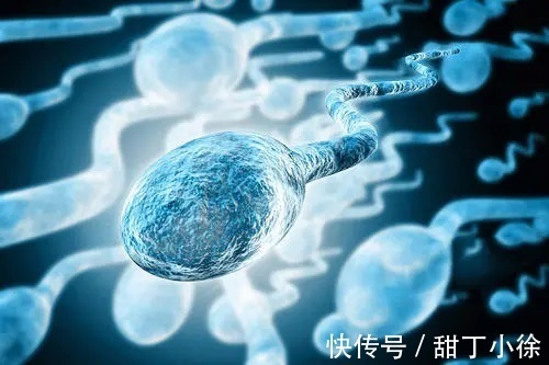 什么是球形精子缺陷
