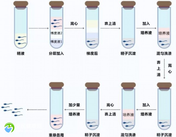 卵巢囊肿是什么意思